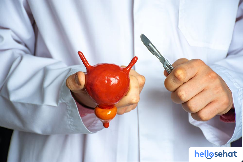 Kistektomi: Panduan Lengkap, Risiko, Pemulihan & Pilihan Terbaik